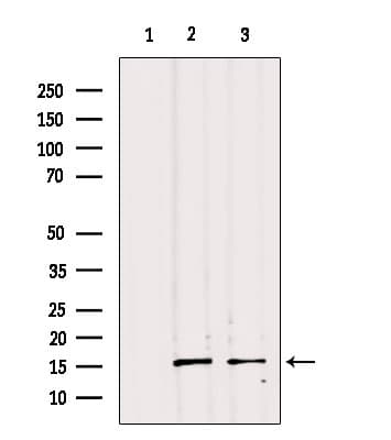 PPP1R14B Antibody