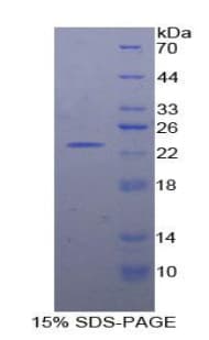 Human RGS4 Protein (Recombinant His-T7)