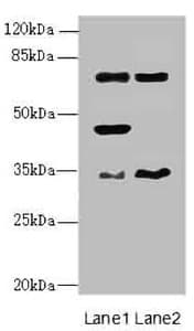 Polyclonal Rabbit anti-Human ESE3 / EHF Antibody (IHC, WB)