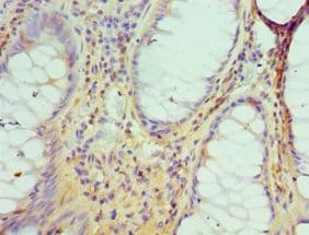 DATF1 / DIDO1 Antibody (aa1-300)