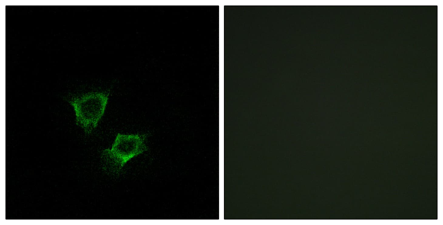 Polyclonal Rabbit anti-Human ZNRF2 Antibody (aa161-210, IF)