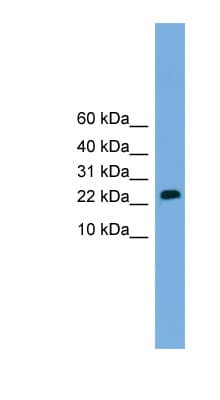 Polyclonal Rabbit anti-Human CSH2 / Placental Lactogen Antibody (aa35-84, IHC, WB)