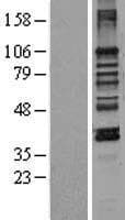 LEMD3 / MAN1 Protein (Over-Expression Lysate Myc-DDK (Flag))