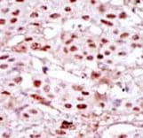 Polyclonal Rabbit anti-Human CSNK2A1 Antibody (aa240-269, IHC, WB)