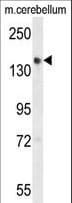 GLG1 / MG160 Antibody (aa1152-1179)