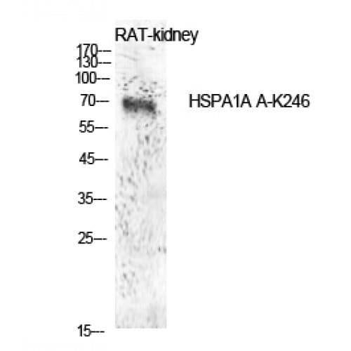 HSPA1A Antibody (Internal)