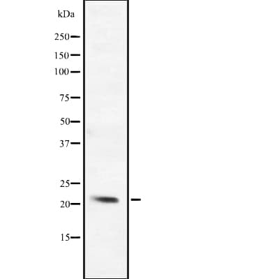 BCL2L10 / Diva Antibody