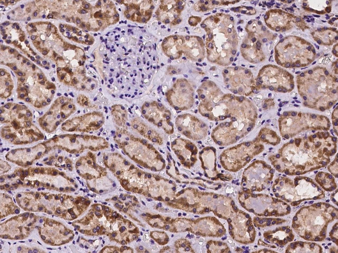 TMEM143 Antibody