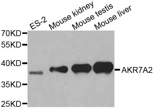 AKR7A2 / AFAR Antibody