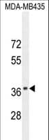 SYNCAM / CADM1 Antibody (aa66-94)