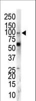 Polyclonal Rabbit anti-Human EPHA5 / EPH Receptor A5 Antibody (aa942-972, IHC, WB)
