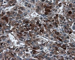 TPMT Antibody (clone OTI2A2)