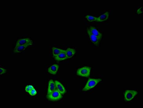 SLC30A8 / ZNT8 Antibody