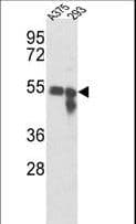 Tyrosinase Antibody (aa176-205)