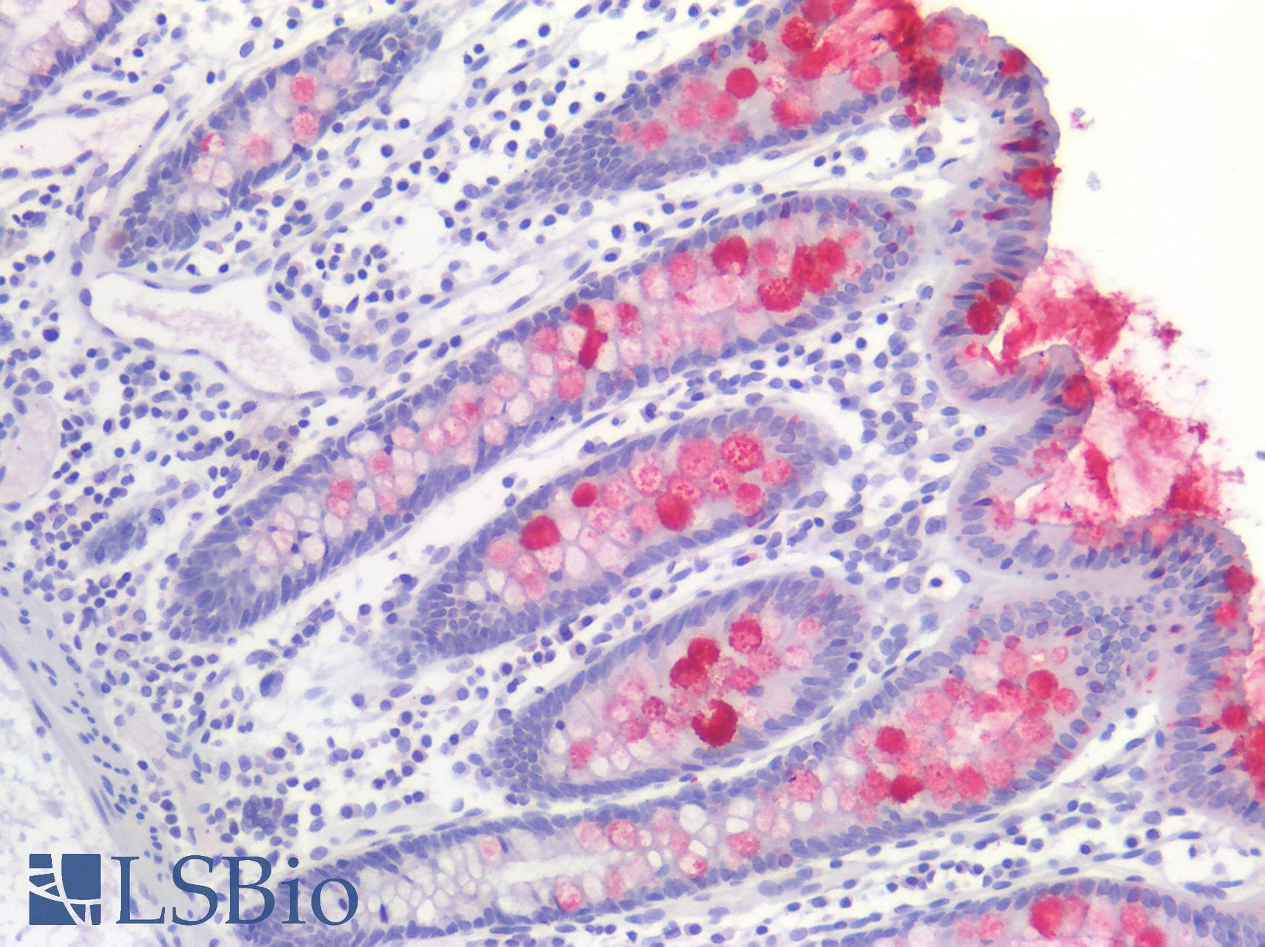 PathPlus™ TFF1 / pS2 Antibody (aa25-84)