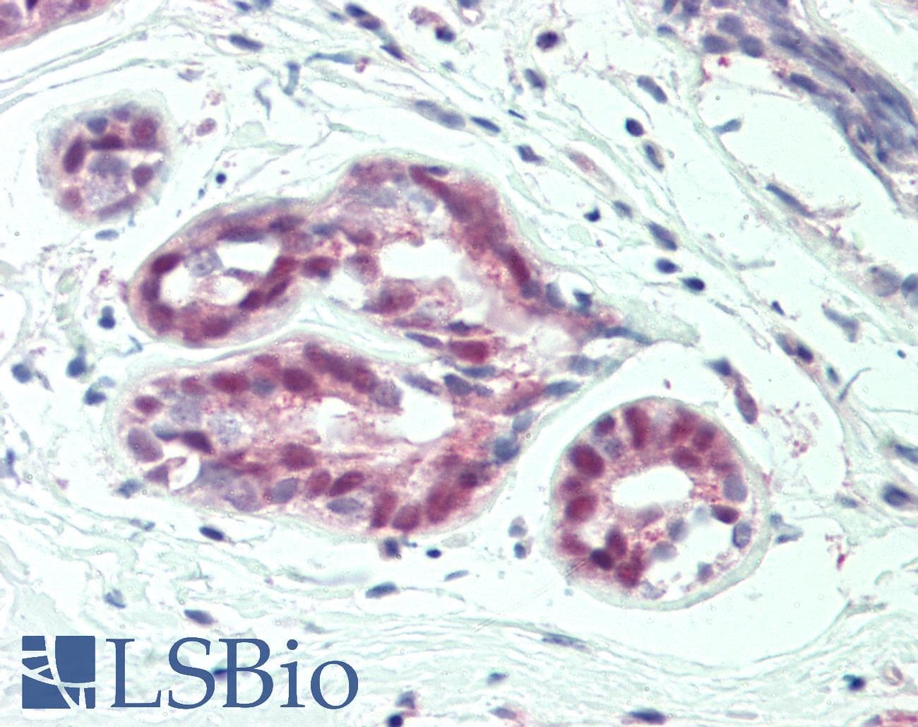 IHC-plus™ PRMT4 / CARM1 Antibody (aa550-C-term)