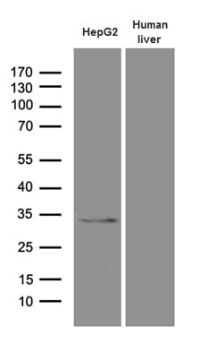 Monoclonal Mouse anti-Human PHYHD1 Antibody (clone OTI1A6, IHC, WB)