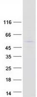 Human PRAMEF19 Protein (Recombinant Myc-DDK (Flag))