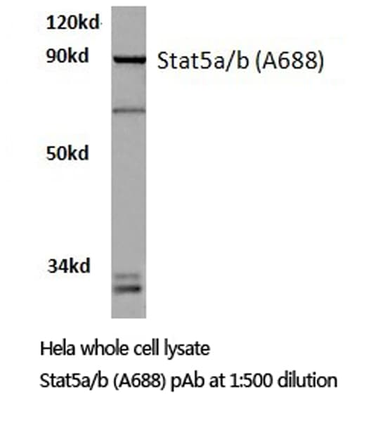 Polyclonal Rabbit anti-Human STAT5 A+B Antibody (Ala688, IHC, WB)
