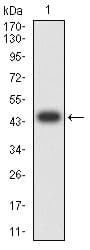 ATRX Antibody (clone 8B2H9)