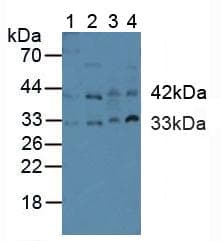 CASP9 / Caspase 9 Antibody (aa331-416, APC)