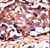 STAT3 Antibody (phospho-Tyr705)