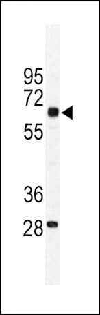 IHC-plus™ PKM / Pyruvate Kinase, Muscle Antibody (aa383-417)