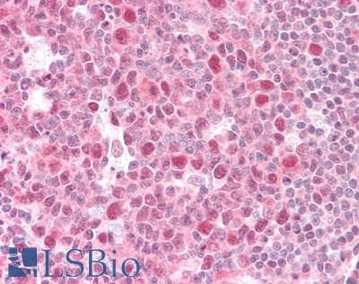 IHC-plus™ Polyclonal Goat anti-Human GPS1 / CSN1 Antibody (aa516-527, IHC, WB)