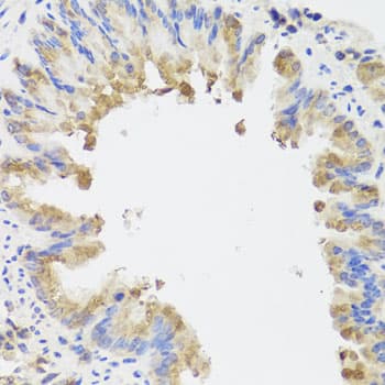 Polyclonal Rabbit anti-Human AMBRA1 Antibody (IHC, WB)
