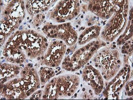 RTKN / Rhotekin Antibody (clone OTI2E9)