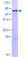 Human PIP4K2C Protein (Recombinant GST)