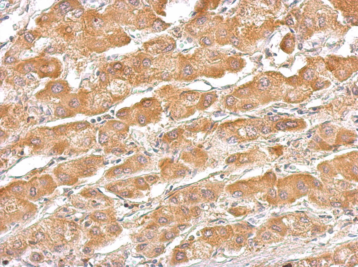 SERPINA7 / TBG Antibody (aa1-371)