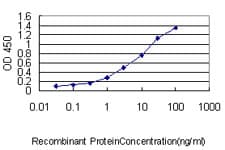 DNAJC7 Antibody (clone 4G6-G3)