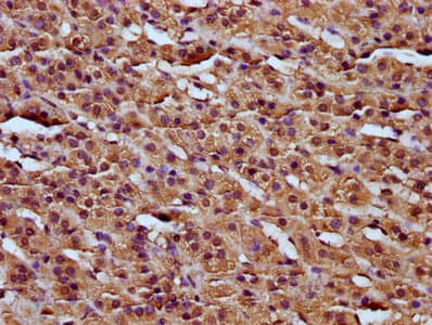 Polyclonal Rabbit anti-Human RCN3 Antibody (IHC)