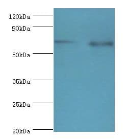 Polyclonal Rabbit anti-Human APBB1IP / RIAM Antibody (aa1-150, IHC, WB)