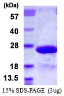 Human MYL7 Protein (Recombinant His)