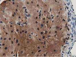 GSTT2 Antibody (clone OTI9A1)