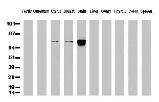 CTNNB1 / Beta Catenin Antibody (clone UMAB15)