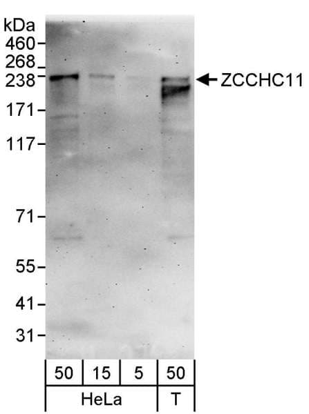 Polyclonal Rabbit anti-Human KIAA0191 / ZCCHC11 Antibody (aa250-300, IHC, WB)