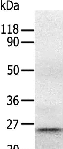 Polyclonal Rabbit anti-Human RAB5A / RAB5 Antibody (WB)