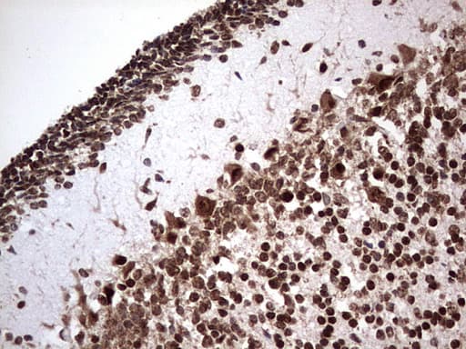 GLI / GLI1 Antibody (aa755-1106, clone OTI2E5)