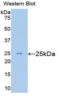 ESAM Antibody (aa29-248)