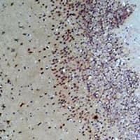 GRPR Antibody