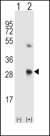 Polyclonal Rabbit anti-Human Osteonectin / SPARC Antibody (aa224-251, IHC, WB)