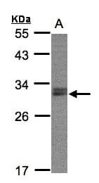 Polyclonal Rabbit anti-Human NSMCE1 Antibody (aa1-266, IHC, WB)