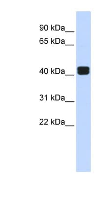 Polyclonal Rabbit anti-Human TRIOBP Antibody (aa144-193, WB)