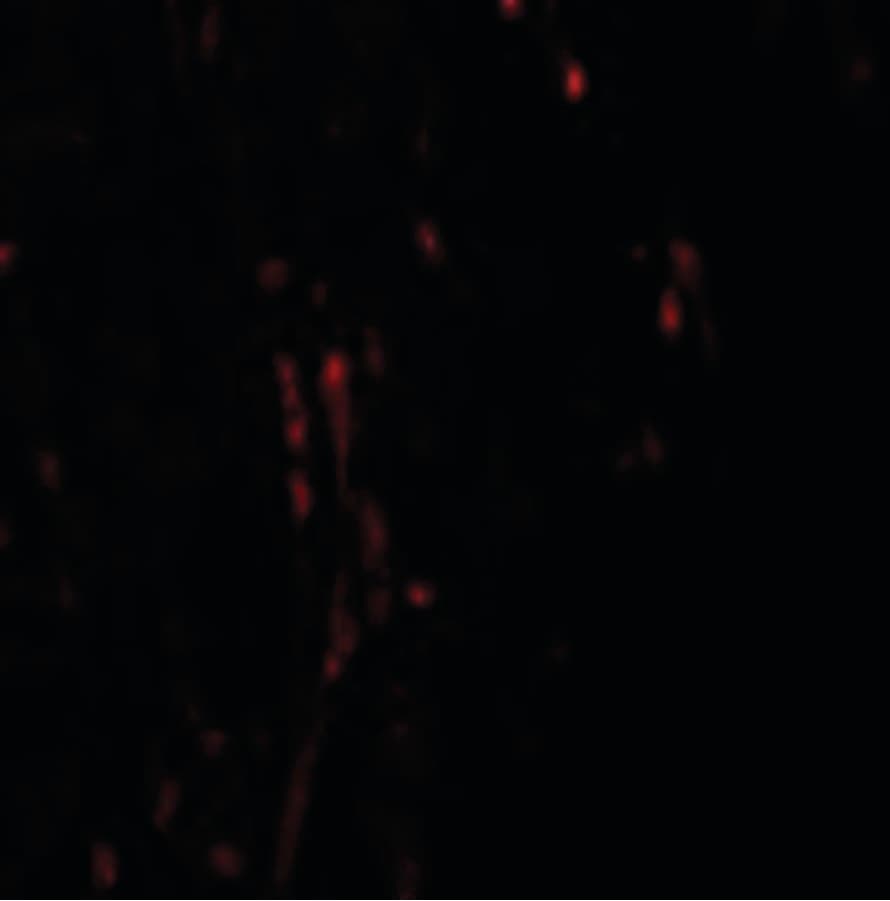 IHC-plus™ Polyclonal Rabbit anti-Human CXXC5 Antibody (IHC, IF, WB)