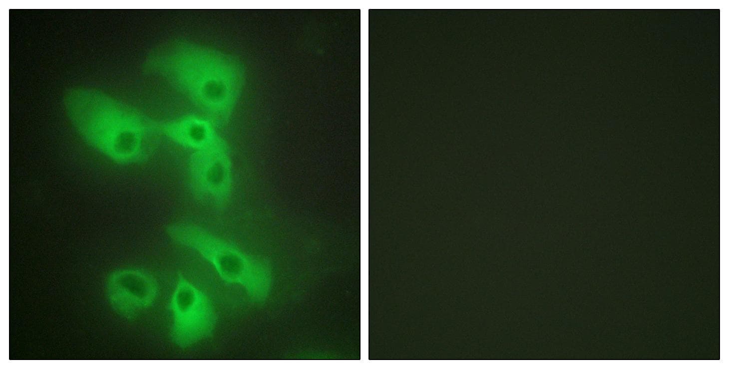 Polyclonal Rabbit anti-Human MAPK8IP2 / JIP2 Antibody (IHC, IF, WB)
