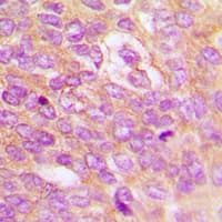 IKBKB / IKK2 / IKK Beta Antibody (phospho-Tyr199)