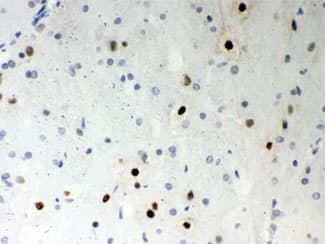 SRSF1 / SF2 Antibody